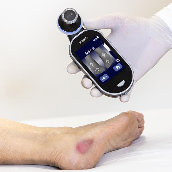 IR-MED to Report New Clinical Efficacy Data for Detection of Pressure Injuries with its AI- Based PressureSafe™ Device at NPIAP 2024 Annual Conference on February 16